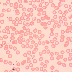 Микроскоп биологический цифровой MAGUS Bio D250TL, фото 14